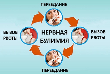 Лечение булимии в Котласе